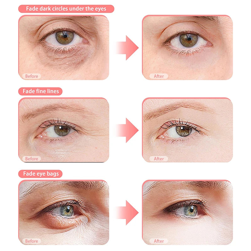 3D Red Light EMS Eye Massager Eyecare Glasses Dark Circles Puffiness Wrinkles Reduction Eye Fatigue Relaxing Beauty Care Device