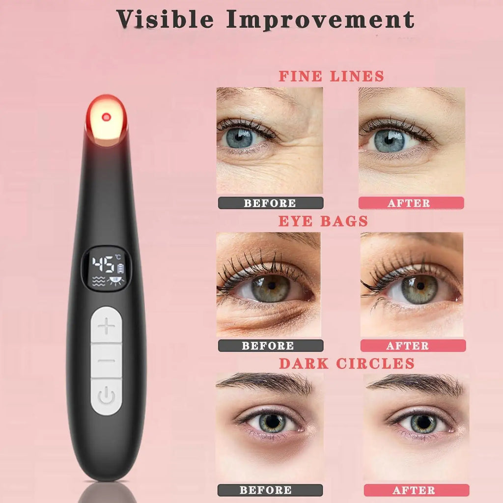 3 in 1 Eye Lift Wand Beauty Device Vibrating Red Light 98°F to 113°F LCD Display Eye Massager for Dry Eye Dark Circle Puffiness