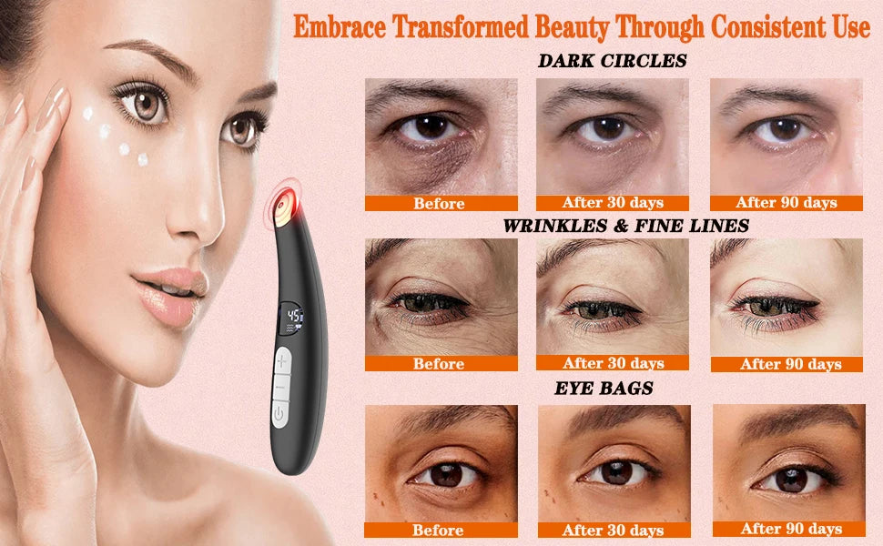 3 in 1 Eye Lift Wand Beauty Device Vibrating Red Light 98°F to 113°F LCD Display Eye Massager for Dry Eye Dark Circle Puffiness